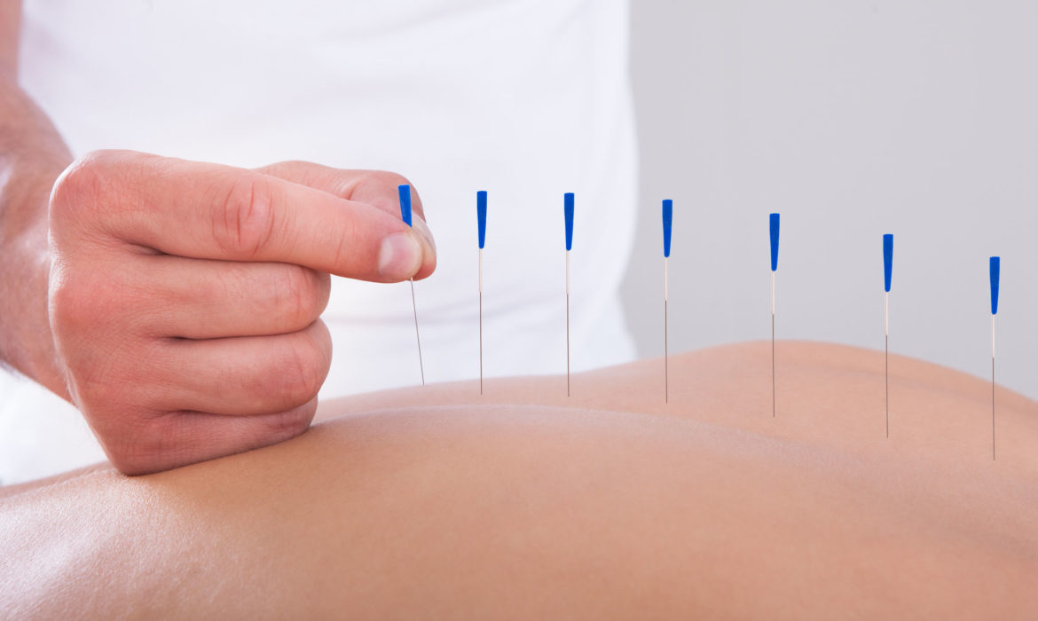 Bodywerks Chiropractic & Acupuncture image 3